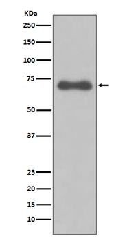 NUMB Rabbit mAb [KD Validated] Antibody