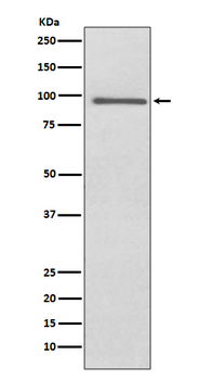 PROX1 Rabbit mAb Antibody