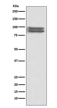 FOXP1 Rabbit mAb Antibody