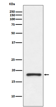 Prealbumin Rabbit mAb Antibody