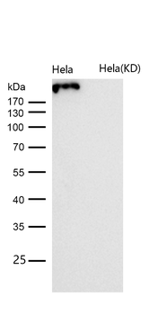 NG2 Rabbit mAb [KD Validated] Antibody