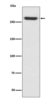 NG2 Rabbit mAb [KD Validated] Antibody