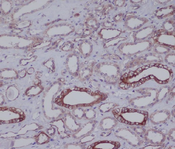 CD90 Rabbit mAb Antibody