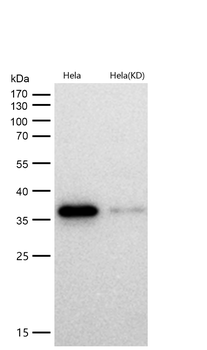 ERCC1 Rabbit mAb [KD Validated] Antibody