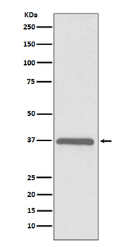 ERCC1 Rabbit mAb [KD Validated] Antibody