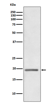 HE4 Rabbit mAb Antibody