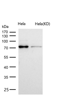 ABCG2 Rabbit mAb [KD Validated]