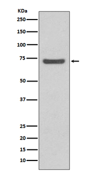 ABCG2 Rabbit mAb [KD Validated]