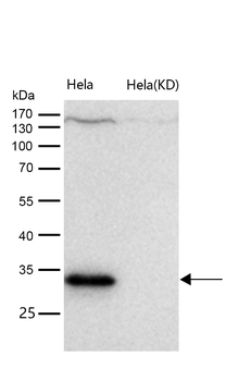CD99 Rabbit mAb [KD Validated]