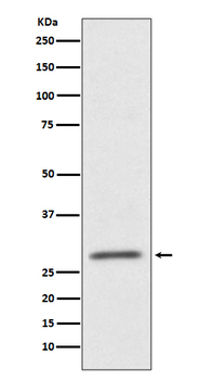 CD99 Rabbit mAb [KD Validated]