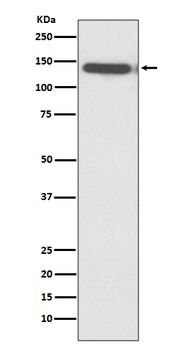 Ctip2 Rabbit mAb Antibody