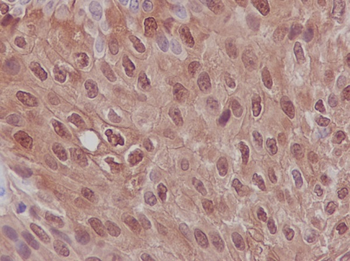 S100P Rabbit mAb