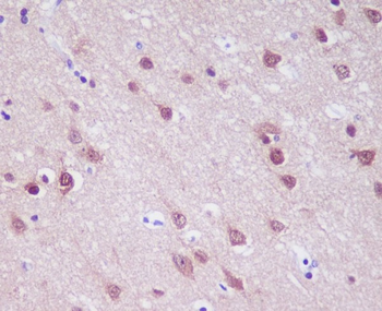 PGP9.5 Rabbit mAb Antibody
