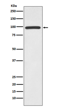 HMGCR Rabbit mAb Antibody