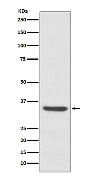 LYVE1 Rabbit mAb Antibody