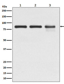 Catenin gamma Rabbit mAb Antibody