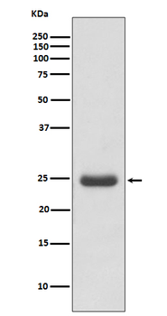 Thymidine Kinase 1 Rabbit Monoclonal Antibody