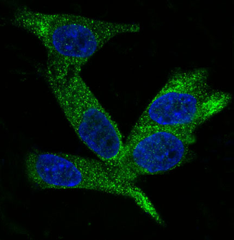 HE4 Rabbit mAb Antibody
