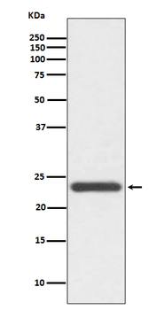 HE4 Rabbit mAb Antibody