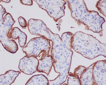 Transferrin Receptor (CD71) Rabbit mAb Antibody
