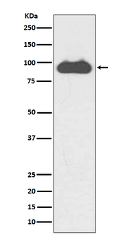 Transferrin Receptor (CD71) Rabbit mAb Antibody