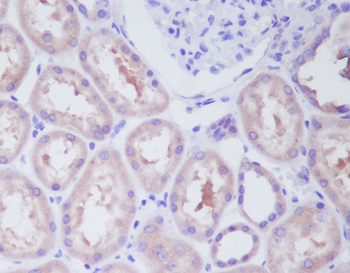 IKK beta Rabbit mAb Antibody