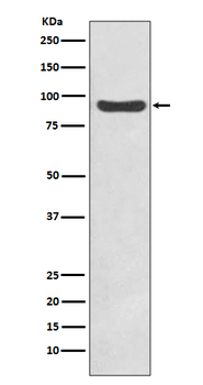 IKK beta Rabbit mAb Antibody