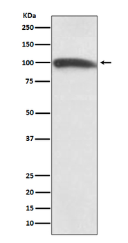 KMT6 / EZH2 Rabbit mAb [KD Validated]