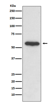 Src Rabbit mAb [KD Validated]