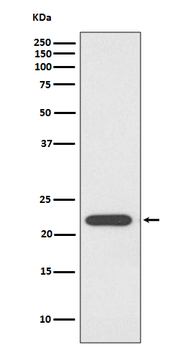 PRDX1 Rabbit mAb  [KD Validated]
