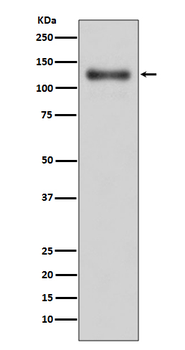 LAMP1 Rabbit mAb [KD Validated] Antibody