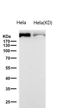 FASN Rabbit mAb Antibody