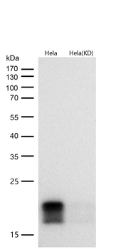 eIF4EBP1 Rabbit mAb [KD Validated]