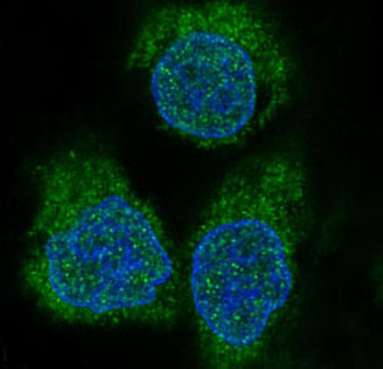 eIF4EBP1 Rabbit mAb [KD Validated]