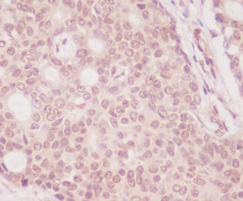 eIF4EBP1 Rabbit mAb [KD Validated]
