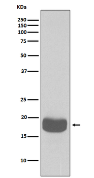 eIF4EBP1 Rabbit mAb [KD Validated]