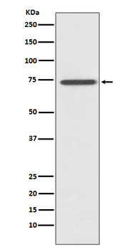 RIP Rabbit mAb Antibody