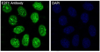 E2F1 Rabbit mAb [KD Validated]
