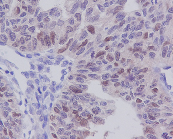 E2F1 Rabbit mAb [KD Validated]