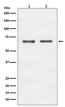 E2F1 Rabbit mAb [KD Validated]