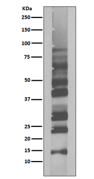 K63-linkage Specific Ubiquitin Rabbit mAb