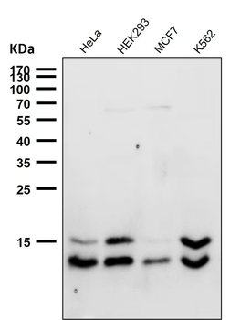 LC3B Rabbit mAb