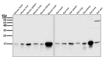 LC3B Rabbit mAb