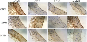 LC3B Rabbit mAb