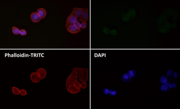 LC3B Rabbit mAb