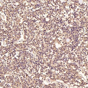 LC3B Rabbit mAb