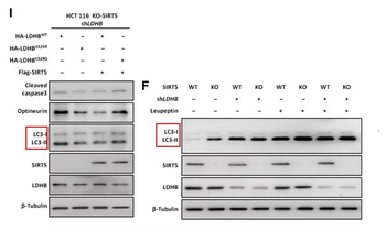 LC3B Rabbit mAb