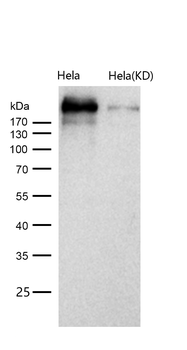 ARID1A Rabbit mAb [KD Validated]