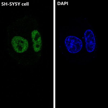 ARID1A Rabbit mAb [KD Validated]