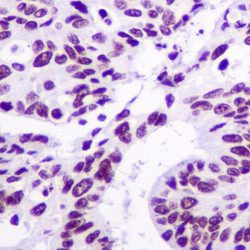 ARID1A Rabbit mAb [KD Validated]